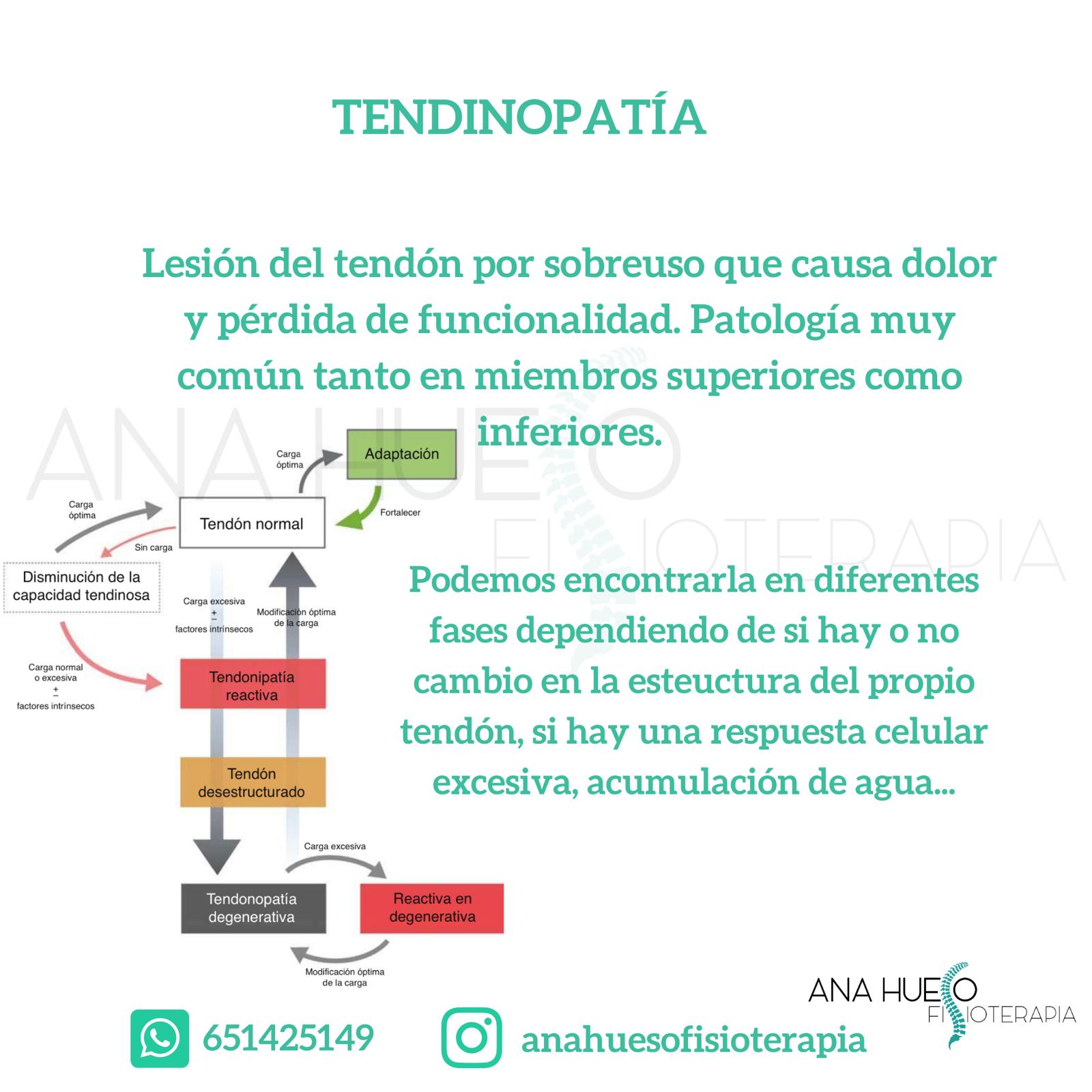 Tendinopatía - Fisioterapia Ana Hueso