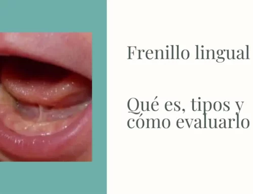 Frenillo lingual: qué es, tipos y cómo evaluarlo