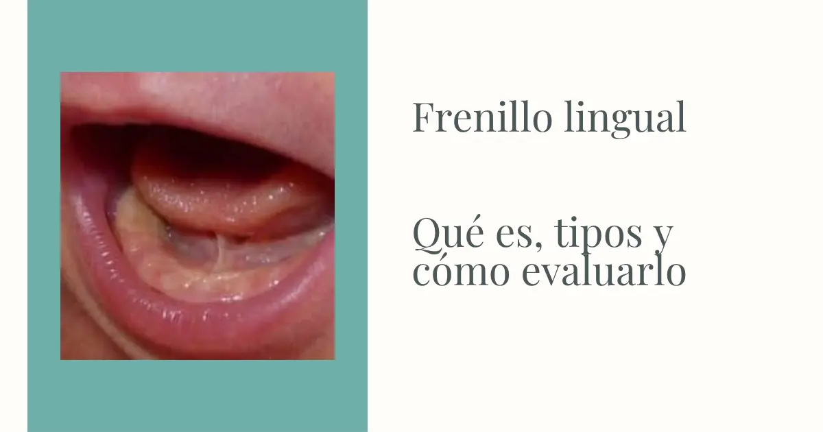 frenillo lingual tratamiento fisioterapia sevilla